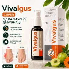 Vivalgus крем сироватка для стоп корекція вальгусної деформації зменшення дискомфорту догляд натуральна формула optD4226 opt-D4226